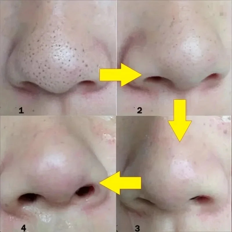 Deep Clean Nose Strips